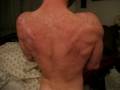 Vascular-Back-Bodybu