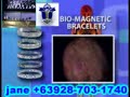 Bio Magnetic Power  Osteoarthritis Muscles