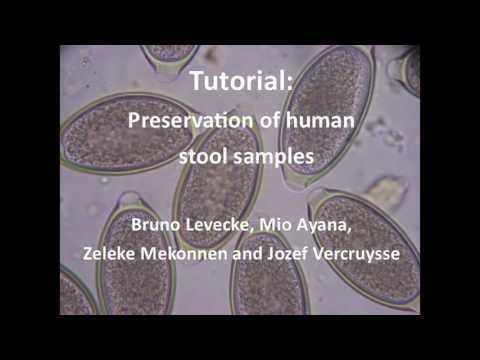 how to collect human stool sample