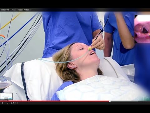 how to perform awake fiberoptic intubation