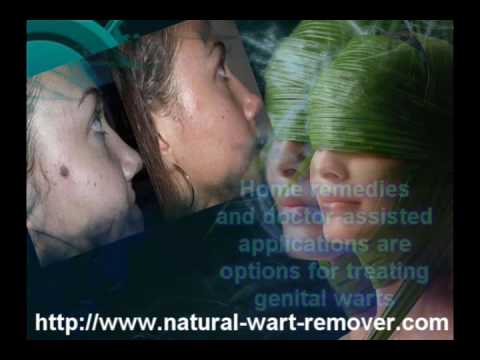 how to relieve embarrassment