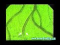 Activation de la microcirculation sanguine grâce au Bemer