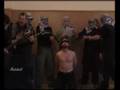 videos de Saddam Hussein Melignant Tumour