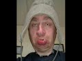 ugly people ugly people
