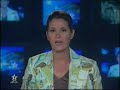 rtm 2m