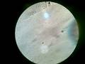 videos de LIVING BACTERIA .. the movment under microscope
