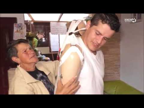 Transformación de vidas - prótesis Transformación de vidas - prótesis