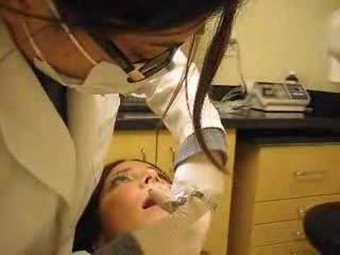 dental fetish - Chelsea at the dentist get 6 cavities fixed, very nice girl.