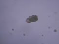Micro-organisme dans le grand lac de Plabennec