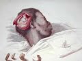 The History Of Mental iIlness - A MontFort College Documentary