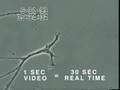 How Mercury Kills the Brain ~ Autism