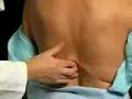 5-Inspection and Palpation - Back 5-Inspection and Palpation - Back