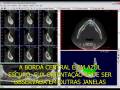 videos de Bioparts - Tutorial 7 DentalSlice: Indicadores