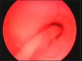 Neurosurgery Endotrainer