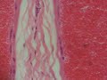 tissue - stratified squamous