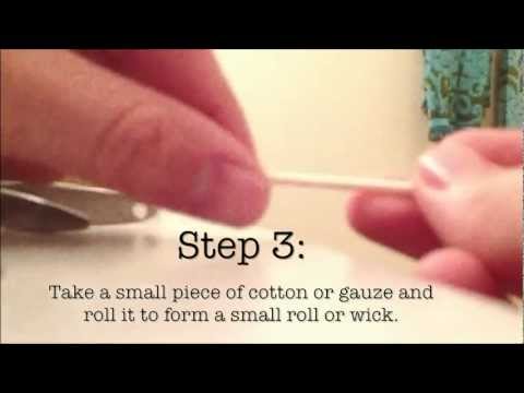 how to treat an ingrown toenail