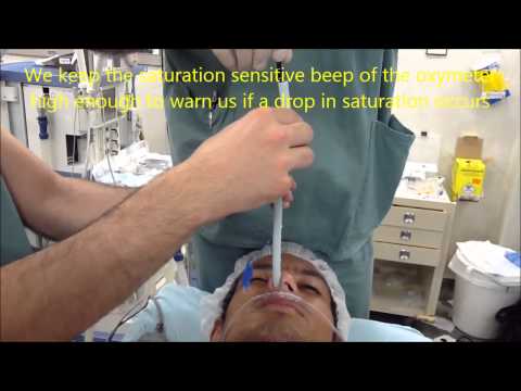 how to perform awake fiberoptic intubation