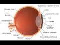Retinoblastoma