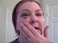 FAT GRAFTING DALLAS:  DEBBIE'S DAILY DIARY