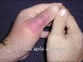 Cuidado com a aranha-marrom. Fotos reais.