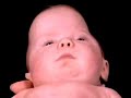 World Craniofacial Foundation