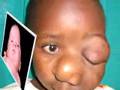 World Craniofacial Foundation