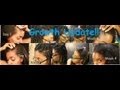 197-whoissugar's Poof Be Gone! 1 month Bald Spot Update