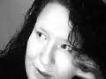 Fibrous Dysplasia and Me