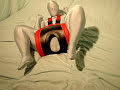 Adult Baby becomes her Hip Abduction Splint