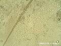videos de Chameleon Fecal Smear Showing Flagellate Parasites Part 1