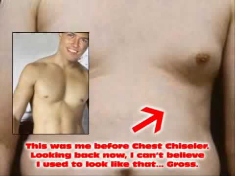 how to cure gynecomastia with exercise