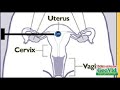 Invetro fertilization