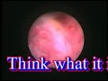 UTERUS
