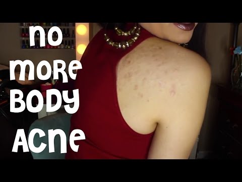 how to cure body acne