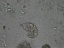 Colpoda 400x