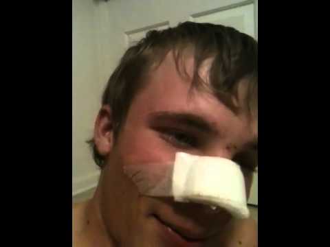 how to trip on vicodin