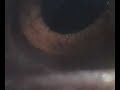 MicroWebCam - Eye - Ojo MicroWebCam - Eye - Ojo
