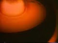 Castle Bravo Explosion Castle Bravo Explosion