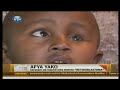 Retinoblastoma : Saratani ya macho kwa watoto