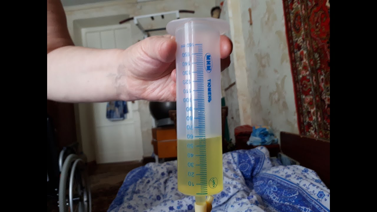 Уретральный стимулятор 