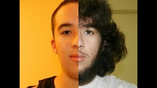 1 Year hair growth time lapse