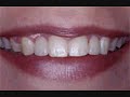 Cosmetic Dental Surgery : Beautiful results affordable dentistry