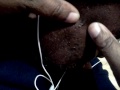 Uncle Willy's  blackhead pt 1
