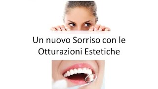 Denti sempre piu' bianchi: le Otturazioni Estetiche.