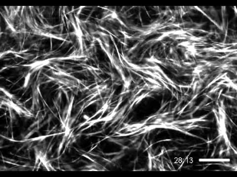 Bundled Active Network of Microtubules