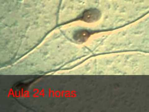 gametos - Video en el que se describe el proceso de gametogénesis en el ser humano.