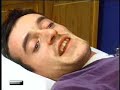 Acupuncture