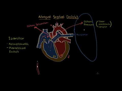 Khan Academy - Atriyal Septal Defekt (Fen Bilimleri) (Sağlık ve Tıp) - 2020.12.17