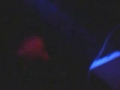 Freak Gasoline Fight Accident