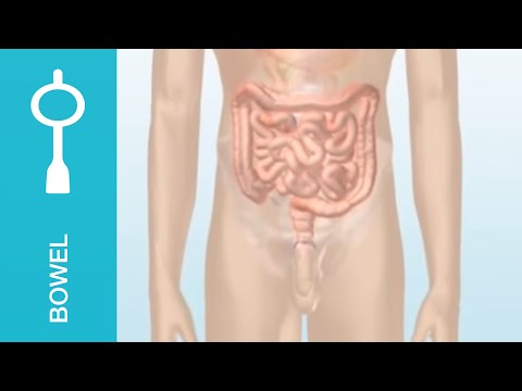 how to relieve severe constipation